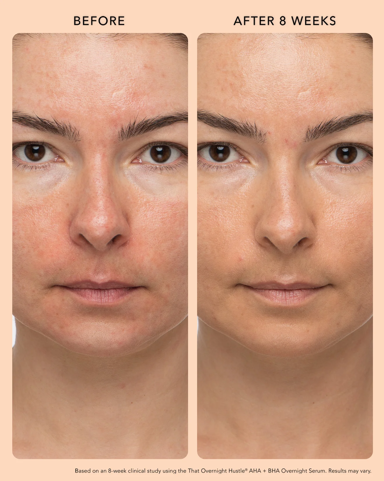 AHA + BHA Overnight Serum - Image 3